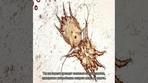 Ушной клещ у кошек: лечение в домашних условиях
