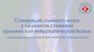 Стимуляция спинного мозга у пациентов с тяжелой хронической нейропатической болью.