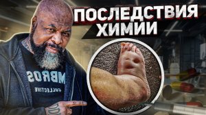 ПЛЕВАЛИ НА ЗДОРОВЬЕ РАДИ МЫШЦ. ЖЕСТКИЕ ПОСЛЕДСТВИЯ