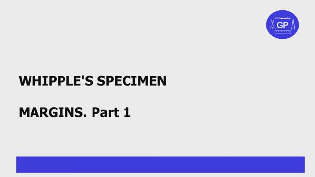 Whipple’s specimen (pancreaticoduodenectomy) margins. Part 1