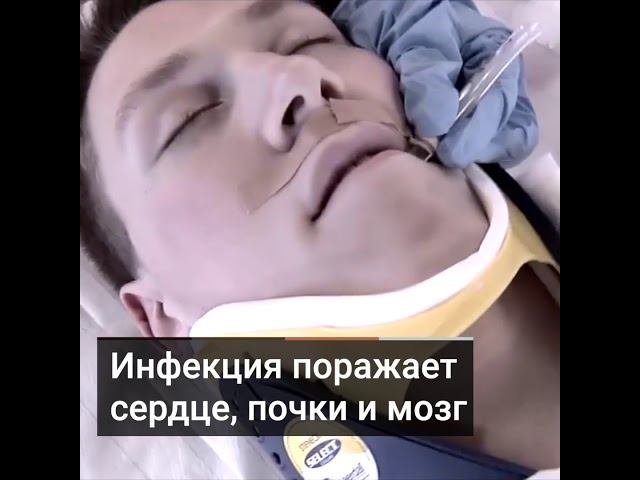 Почему коронавирус опаснее