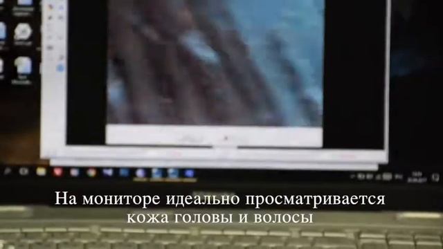 Трихолог и трихоскопия в Самаре