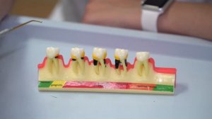 Лечение пародонтита