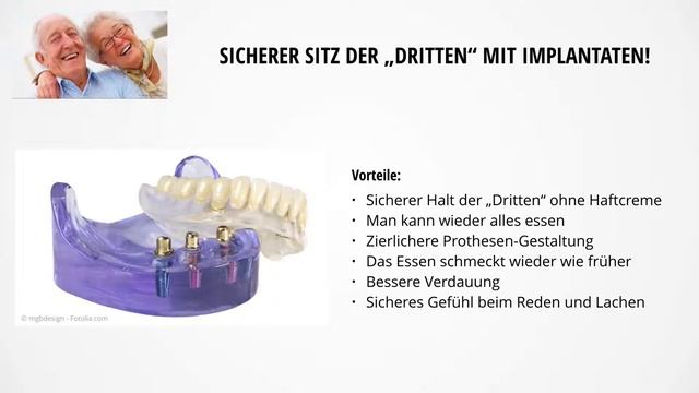 Implantat-Zahnarzt Darmstadt Griesheim - Markus Belt M.Sc. смотреть онлайн