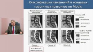 Тревога, апатия, депрессия у пациентов с болью в спине