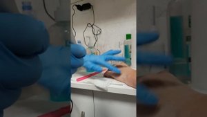 Процедура плазменный душ