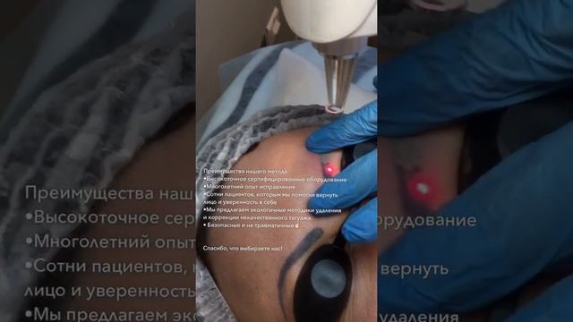 Удаление бровей неодимовый лазер Консультация и запись по ?92-888-32 ?9-(911)-92-888-32 WApp/Viber