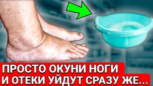 Всего ОДНА ВАННОЧКА и ОТЕКИ УЙДУТ... И ещё несколько способов избавиться от отёков ног