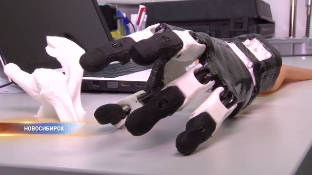 Новосибирские разработчики создали умный протез смотреть онлайн
