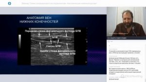Вебинар Схема ультразвукового исследования вен. Анатомическая номенклатура вен нижних конечностей