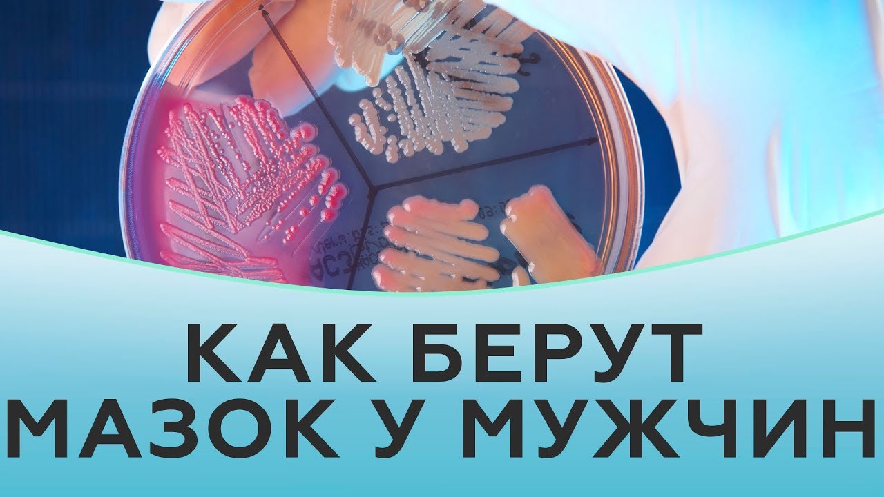 Как берут мазок у мужчин.