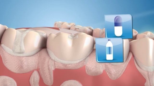 Неприятный запах изо рта: основные причины появления и способы предотвращения смотреть онлайн