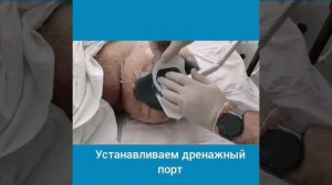 Установка системы для VAC терапии (NPWT)