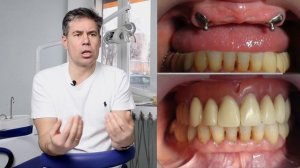 Лучший съемный протез. Что это такое?