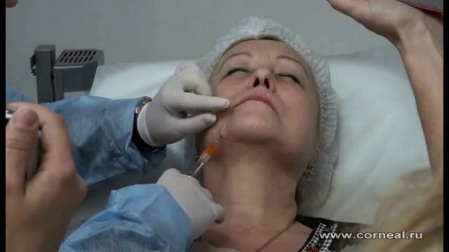 Уникальная школа пластического хирурга Карповой Е И. Урок первый