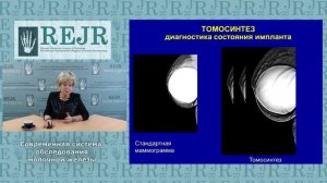 Современные методы обследования молочной железы.