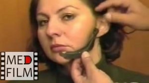 Имплантат нижней челюсти, академик Н.Н.Бажанов © Implant of the lower jaw