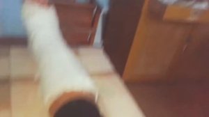 ШОК!!!! МНЕ ОТРЕЗАЛИ НОГУ!?