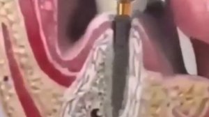 Как делают голливудскую улыбку