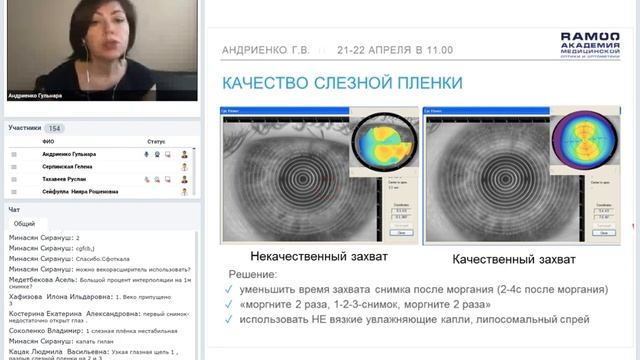 Вебинар «Топографическая оценка роговицы в Ортокератологии» – часть 1. смотреть онлайн