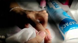 Удаление татуировки самостоятельно  дома почти бесплатно