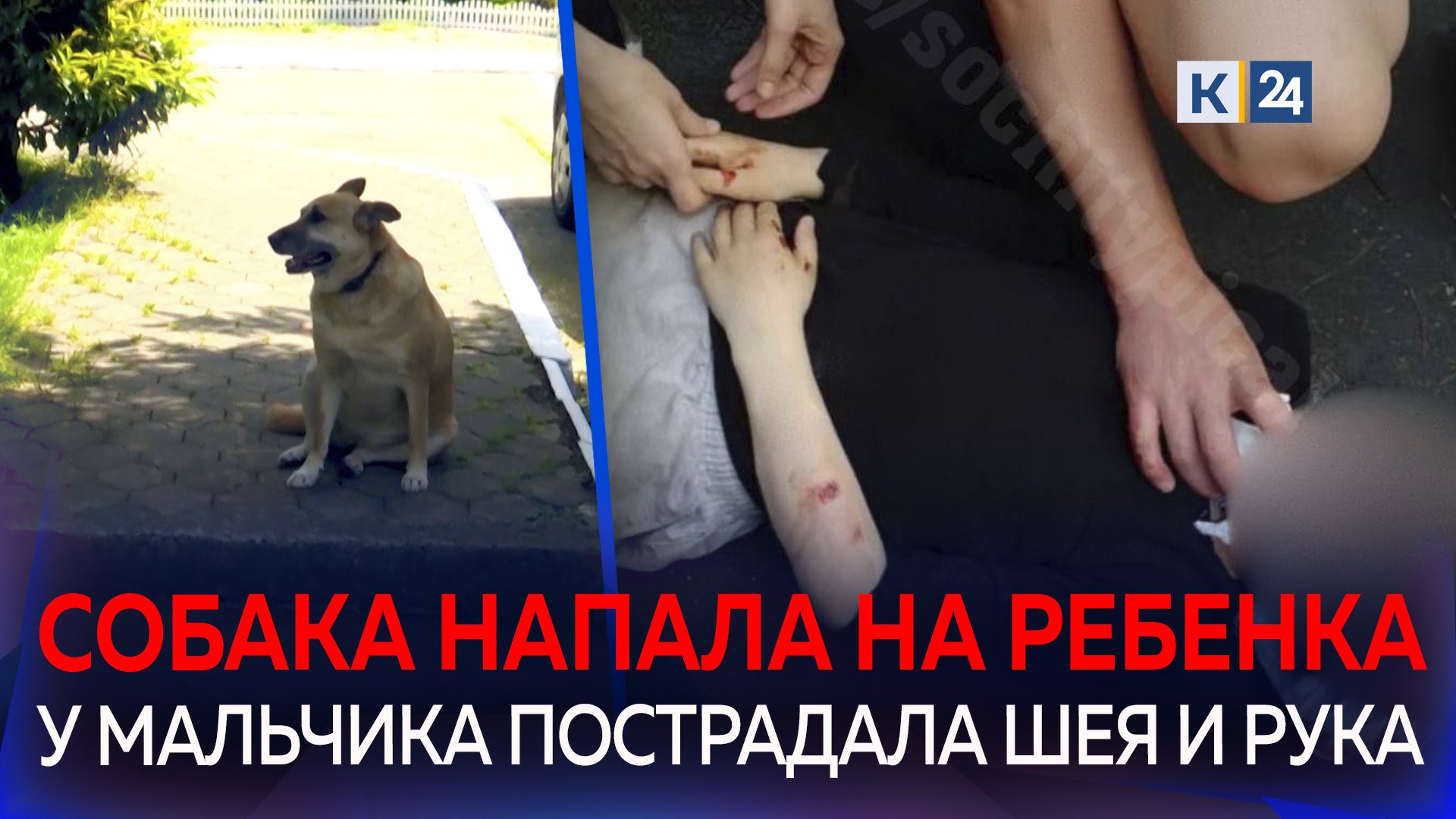 Овчарка вцепилась в горло 9-летнему мальчику в Сочи