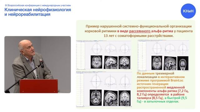 Гетерогенность альфа-ритма ЭЭГ – свидетельство снижения уровня психической стрессоустойчивости смотреть онлайн