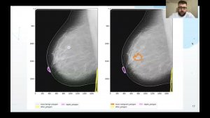Евгений Никитин | Оценка ML-моделей на медицинских данных
