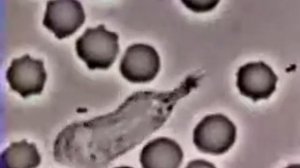 White Blood Cell (Neutrophil) Eats (phagocytosis) Bacteria: Staphylococcus Aureus