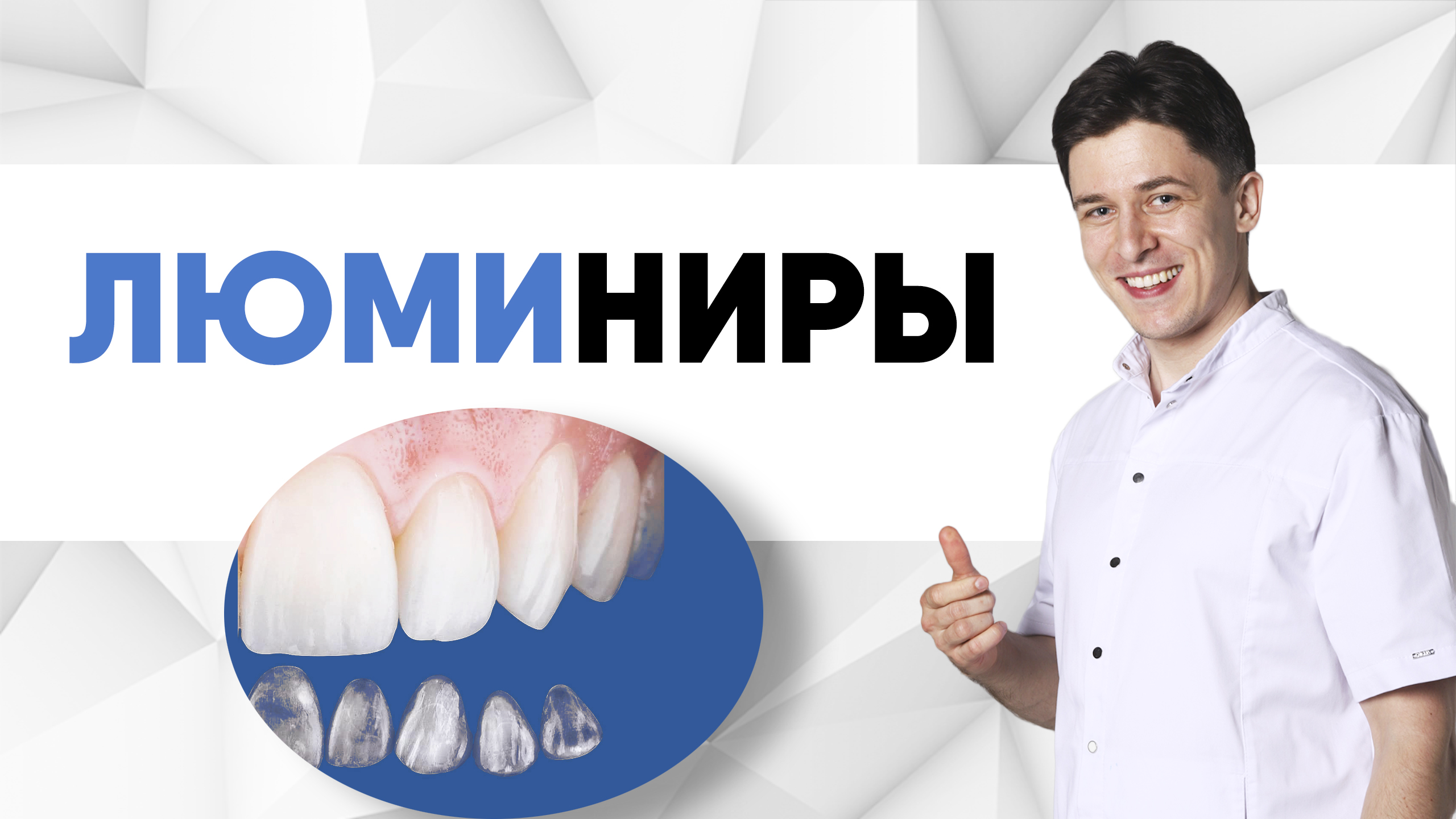 Люминиры хуже виниров e.max? Почему лучше НЕ ставить люминиры?