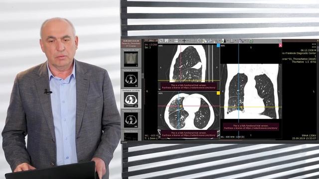 Клінічний випадок: емфізема, хронічний бронхіт, негоспітальна пневмонія смотреть онлайн