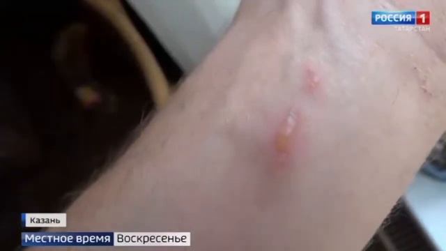 Чем опасен борщевик? смотреть онлайн