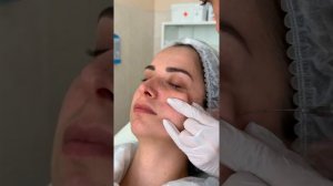 КОНТУРНАЯ ПЛАСТИКА СРЕДНЕЙ ТРЕТИ ЛИЦА