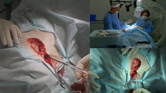 Мастоцитома на коже у собаки. Удаление новообразования. смотреть онлайн