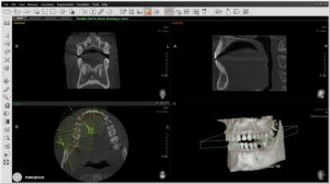Возможности программы Ez3D: реформат ОПТГ
