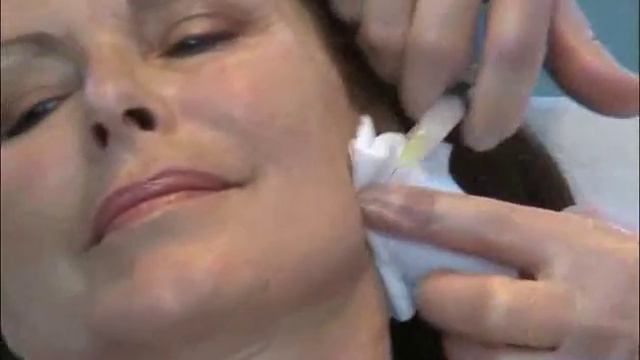 Viscoderm 16 30 Gneedle Dr Salti