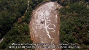 Покраснение глаз: почему оно появляется и как бороться