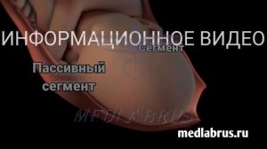 Вагинальные роды- первая стадия