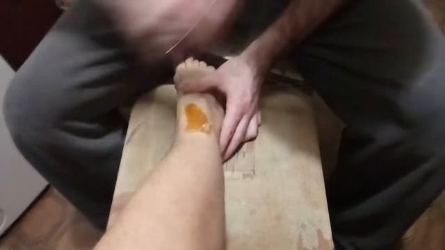 илеальный шугаринг ложкой