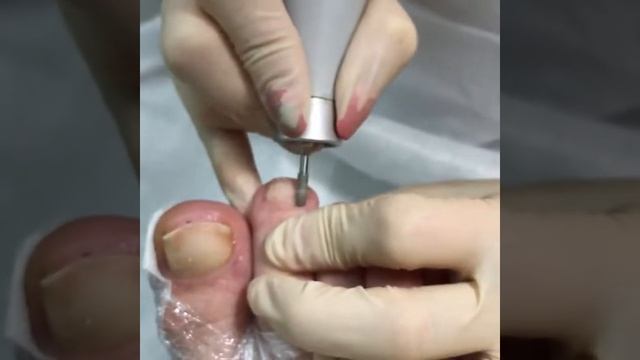 Аппаратный педикюр с применением Биокосметики Brilliant Feet смотреть онлайн