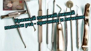 Красный плоский лишай полости рта - причины и лечение