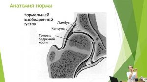 Дисплазия тазобедренных суставов