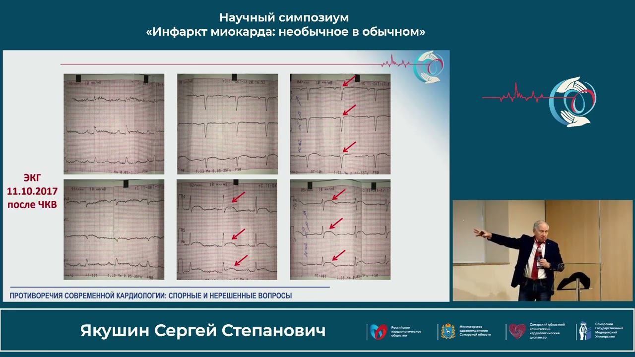 22.10 Научный симпозиум «Инфаркт миокарда: необычное в обычном»