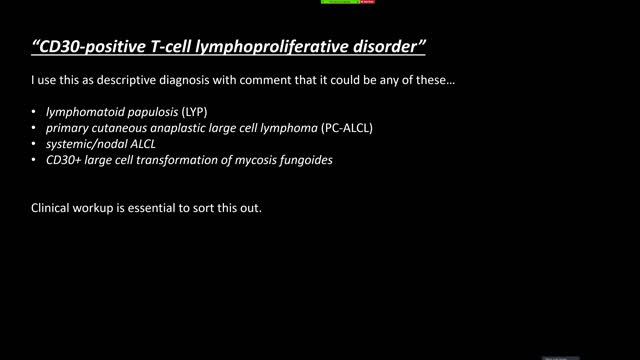 Cutaneous Hemepath 101 (Skin Lymphoma, Leukemia, & Histiocytic Infiltrate Basics) Hematopathology смотреть онлайн
