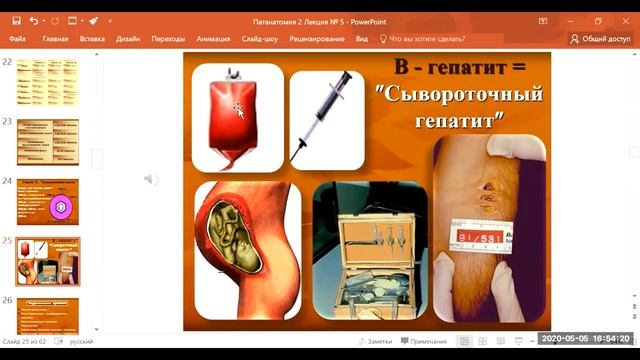 Patoloji anatomiya kafedrası - Патологическая анатомия болезней печени (Практическое занятие №7) смотреть онлайн