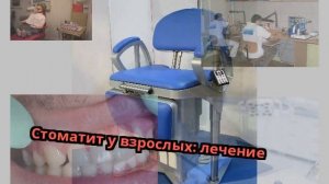 Стоматит у взрослых: лечение