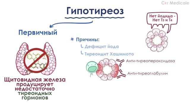 Гипотиреоз обзорно: механизм развития, основные симптомы, принципы лечения
