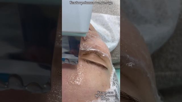 Чистка лица смотреть онлайн