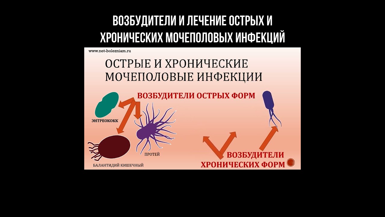 Возбудители и лечение острых и хронических мочеполовых инфекций смотреть онлайн