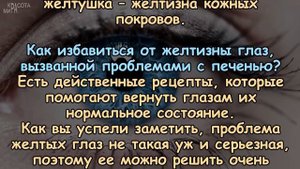 Как избавиться от ЖЕЛТИЗНЫ ГЛАЗНЫХ БЕЛКОВ и в чём причины ее появления